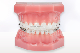 効率的に歯を動かす治療システム